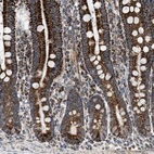 Immunohistochemical staining of human duodenum shows strong granular cytoplasmic positivity in glandular cells.