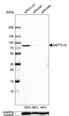 Anti-METTL16 Antibody