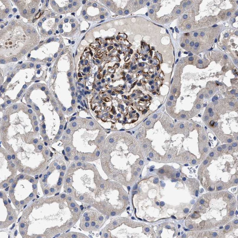 Anti-TSPAN33 Antibody