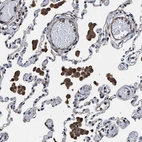 Immunohistochemical staining of human lung shows strong cytoplasmic positivity in macrophages.