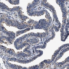 Immunohistochemical staining of human fallopian tube shows very weak cytoplasmic positivity in glandular cells and ciliated cells.