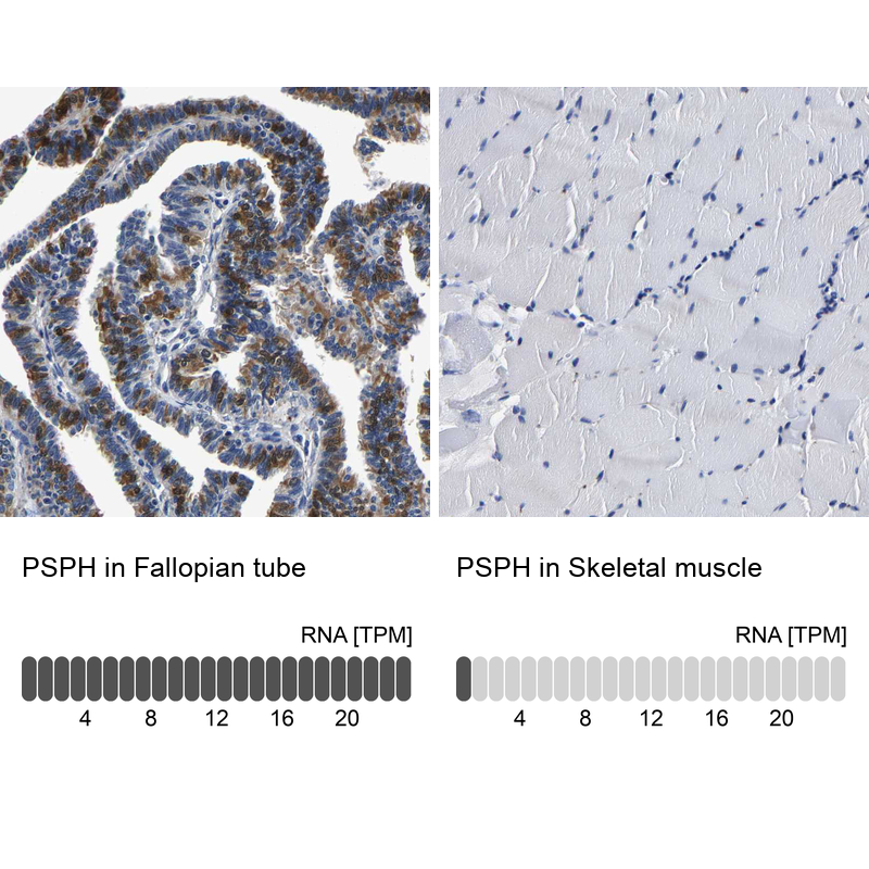 Anti-PSPH Antibody