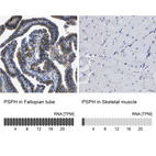 Anti-PSPH Antibody