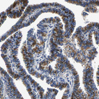 Immunohistochemical staining of human Fallopian tube shows strong cytoplasmic positivity in glandular cells.