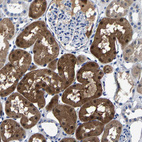 Immunohistochemical staining of human kidney shows strong cytoplasmic positivity in cells in tubules.