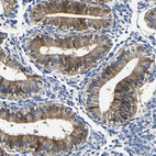 Immunohistochemical staining of human endometrium shows moderate cytoplasmic positivity in glandular cells.