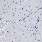 Immunohistochemical staining of human skeletal muscle shows no positivity in myocytes as expected.