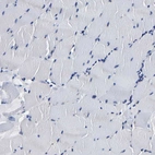 Immunohistochemical staining of human skeletal muscle shows no positivity in myocytes as expected.