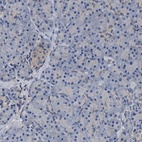 Anti-IDNK Antibody