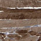 Anti-SLC25A25 Antibody