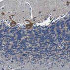 Immunohistochemical staining of human cerebellum shows strong cytoplasmic positivity in Purkinje cells.