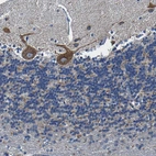 Immunohistochemical staining of human cerebellum shows strong cytoplasmic positivity in Purkinje cells.