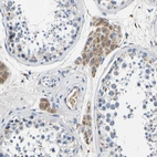 Immunohistochemical staining of human testis shows moderate cytoplasmic positivity in Leydig cells.