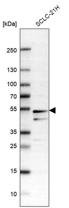 Western blot analysis in human cell line SCLC-21H.