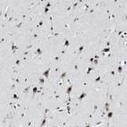 Immunohistochemical staining of human cerebral cortex shows strong nuclear positivity in neurons.