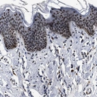 Immunohistochemical staining of human skin shows strong nuclear positivity in keratinocytes.
