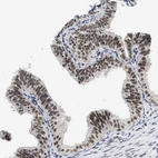 Immunohistochemical staining of human fallopian tube shows strong nuclear positivity in glandular cells.