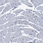 Immunohistochemical staining of human skeletal muscle shows no positivity in myocytes as expected.