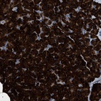 Anti-ZC3HAV1L Antibody