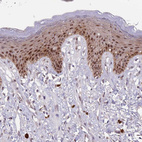 Anti-CIZ1 Antibody