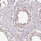 Immunohistochemical staining of human testis shows moderate nuclear positivity in spermatids.