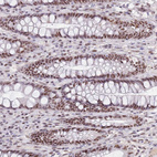 Anti-CIZ1 Antibody