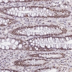 Immunohistochemical staining of human rectum shows strong nuclear positivity in glandular cells.