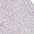 Anti-CIZ1 Antibody