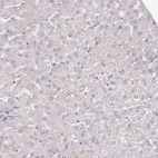 Immunohistochemical staining of human liver shows no nuclear positivity in hepatocytes as expected.