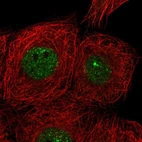 Immunofluorescent staining of human cell line MCF7 shows localization to nucleoplasm.