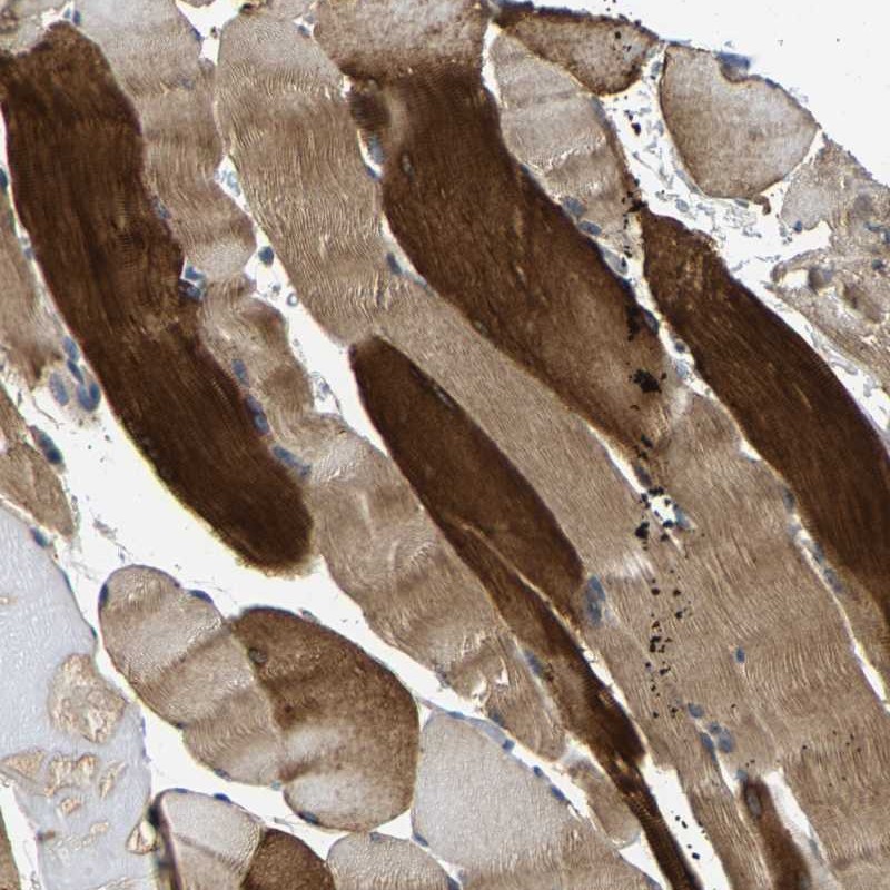 Anti-AGBL3 Antibody