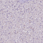 Immunohistochemical staining of human liver shows no positivity in hepatocytes as expected.