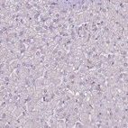 Immunohistochemical staining of human liver shows no positivity in hepatocytes as expected.