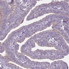 Immunohistochemical staining of human fallopian tube shows weak cytoplasmic positivity in glandular cells as expected.