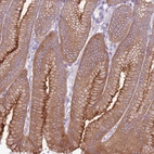 Immunohistochemical staining of human stomach shows moderate cytoplasmic positivity in glandular cells.