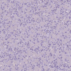 Immunohistochemical staining of human pancreas shows no positivity in exocrine glandular cells as expected.