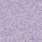 Immunohistochemical staining of human pancreas shows no positivity in exocrine glandular cells as expected.