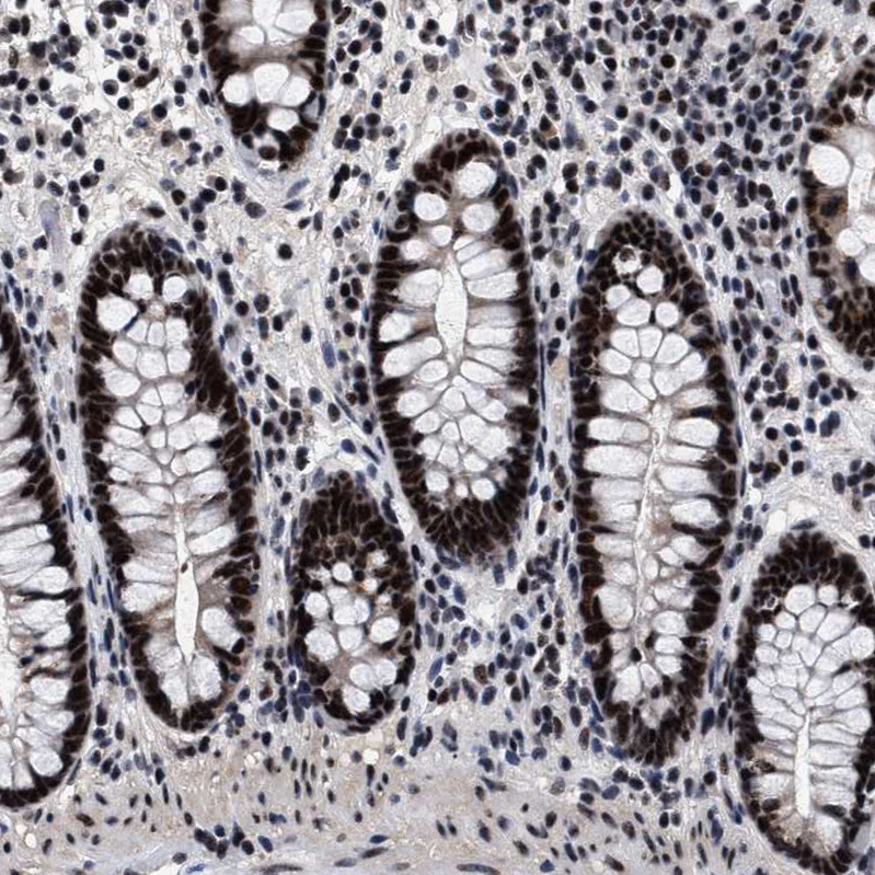 Anti-CAAP1 Antibody