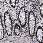 Anti-CAAP1 Antibody