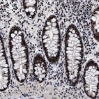 Anti-CAAP1 Antibody