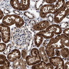 Immunohistochemical staining of human kidney shows strong nuclear and cytoplasmic positivity in cells in tubules.