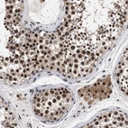 Immunohistochemical staining of human testis shows moderate nuclear positivity in cells in seminiferous ducts.