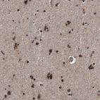 Immunohistochemical staining of human cerebral cortex shows strong nuclear positivity in neurons.