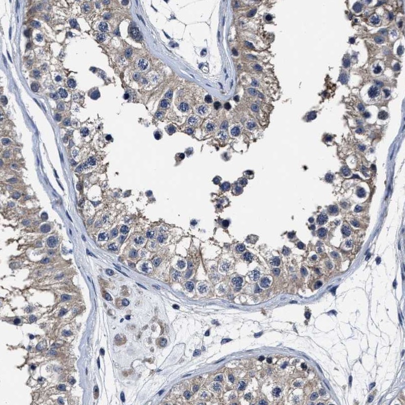 Anti-RSBN1L Antibody