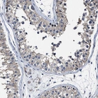 Anti-RSBN1L Antibody