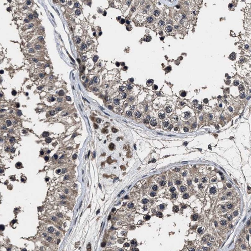 Anti-RSBN1L Antibody
