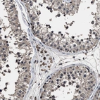 Anti-RSBN1L Antibody