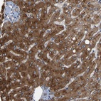 Anti-RGP1 Antibody