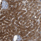 Anti-RGP1 Antibody