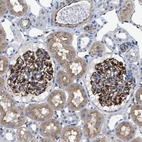Anti-PKD1L1 Antibody